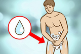 Cách vệ sinh sau khi đi tiểu cho nam giới đúng cách