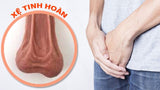 Bìu bị chảy xệ có nguy hiểm không? Nguyên nhân và cách khắc phục