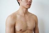vết tròn bị nổi đốm đỏ trên da và ngứa