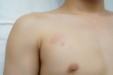 Sữa Tắm Trị Viêm Nang Lông Cho Nam Giúp Giảm Ngứa, Sáng Da