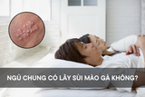 Ngủ chung có lây sùi mào gà không? Những dấu hiệu nhận biết