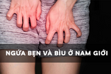 Ngứa bẹn và bìu ở nam giới: Dấu hiệu bệnh gì, có nguy hiểm không?