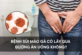 Bệnh sùi mào gà có lây qua đường ăn uống không?