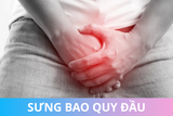 Sưng bao quy đầu: Giải đáp nguyên nhân, cách chữa, khi nào gặp bác sĩ
